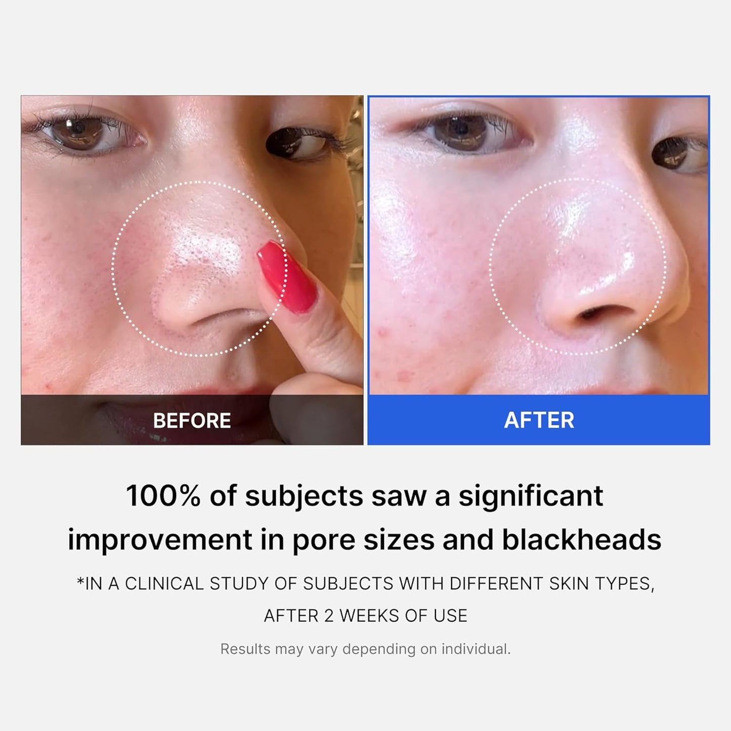 MEDICUBE Zero Pore Pad 2.0 (70 unidades)