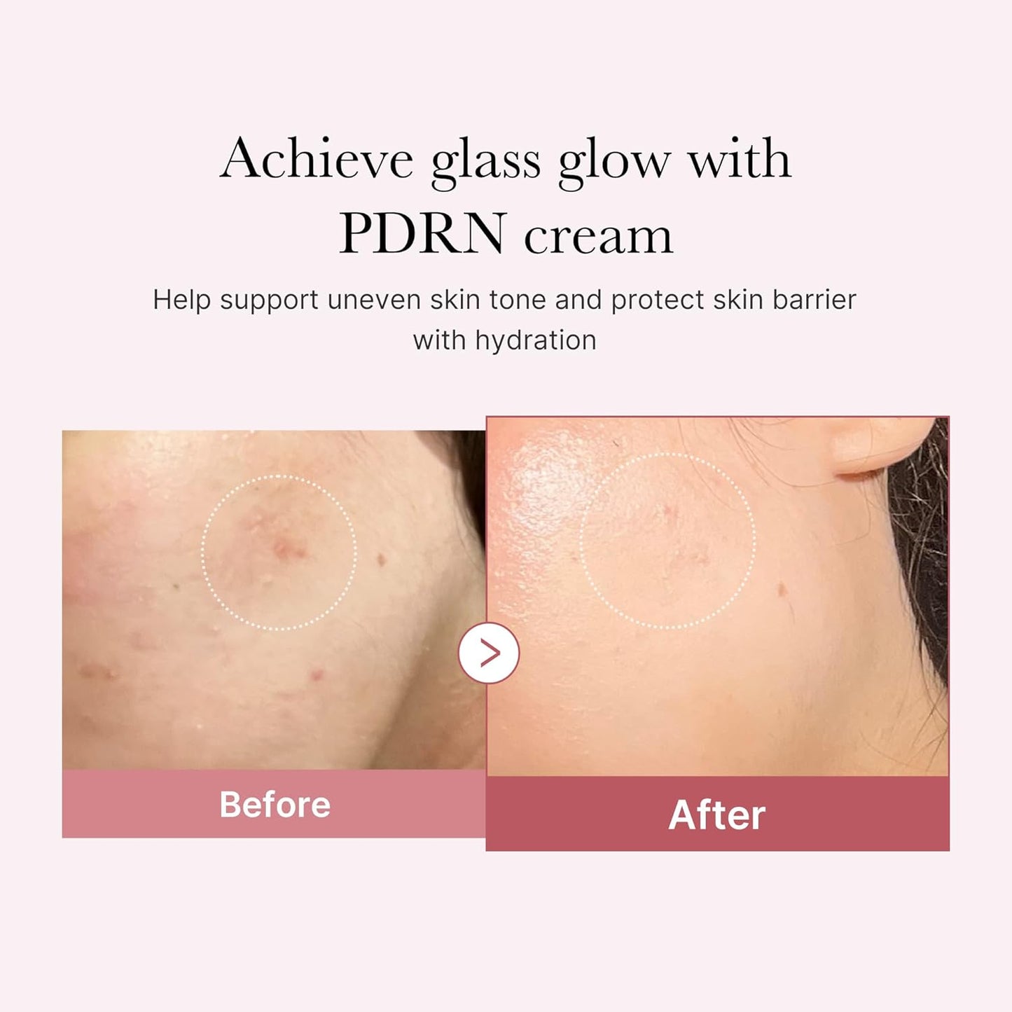 Medicube - Crema hidratante con ácido hialurónico PDRN Pink Hyaluronic Moisturizing Cream