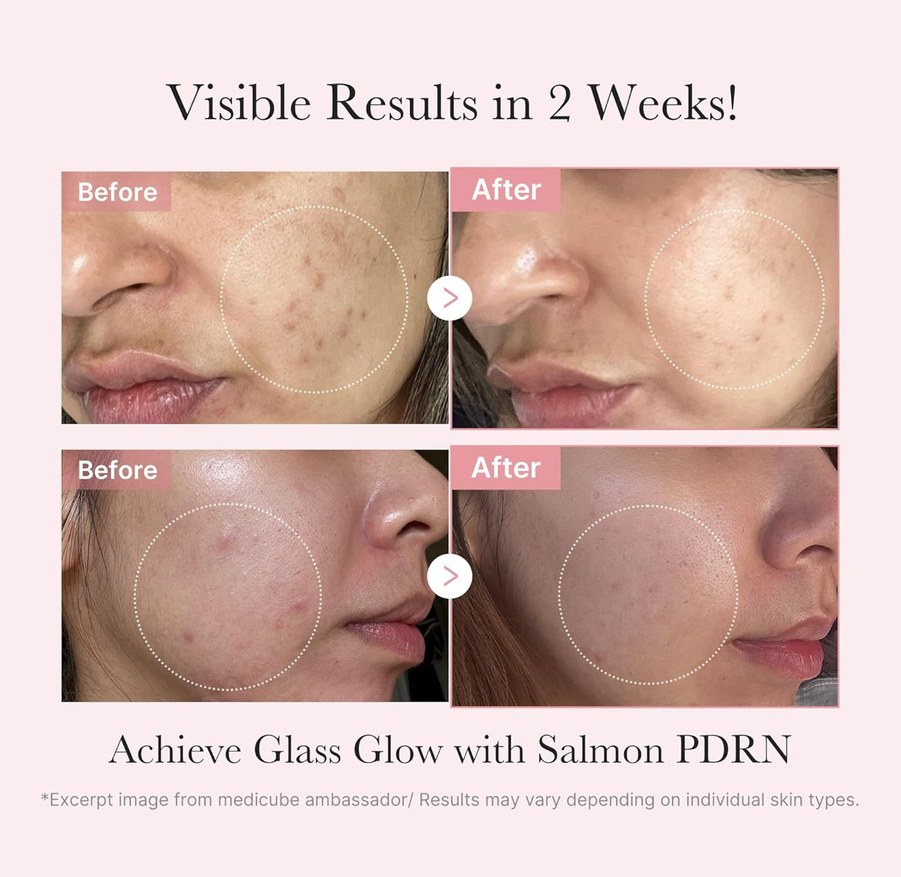 Medicube PDRN glow kit