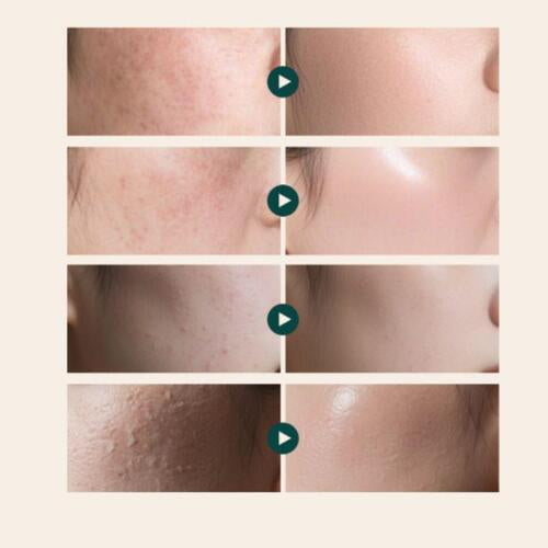 REJUALL Advanced PDRN Relief Cream