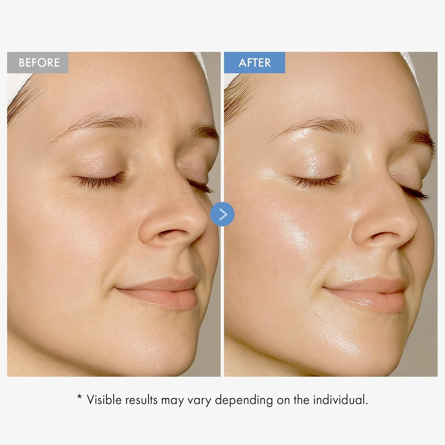 TOSOWOONG Hyaluronic Acid 9 Cream