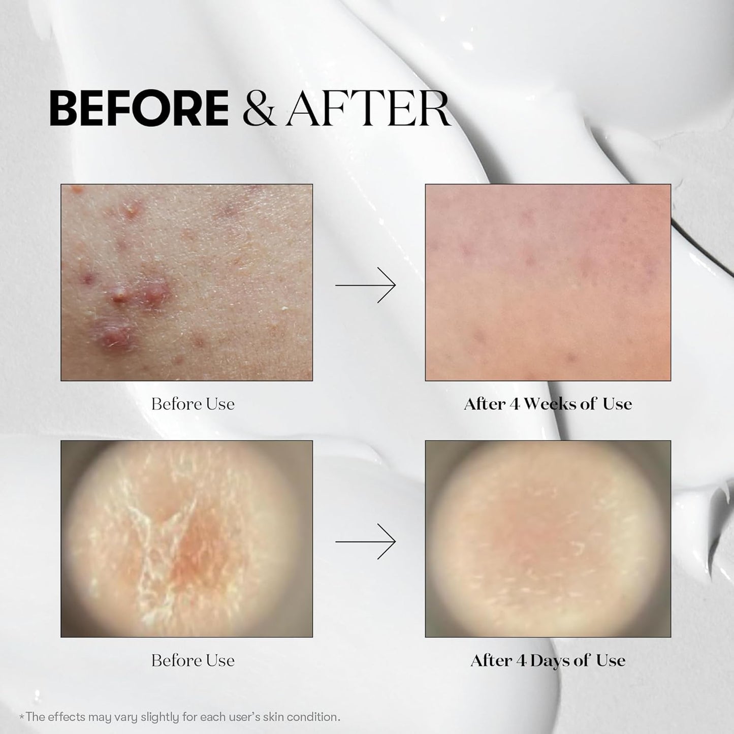 VT Cosmetics Reedle Shot kit
