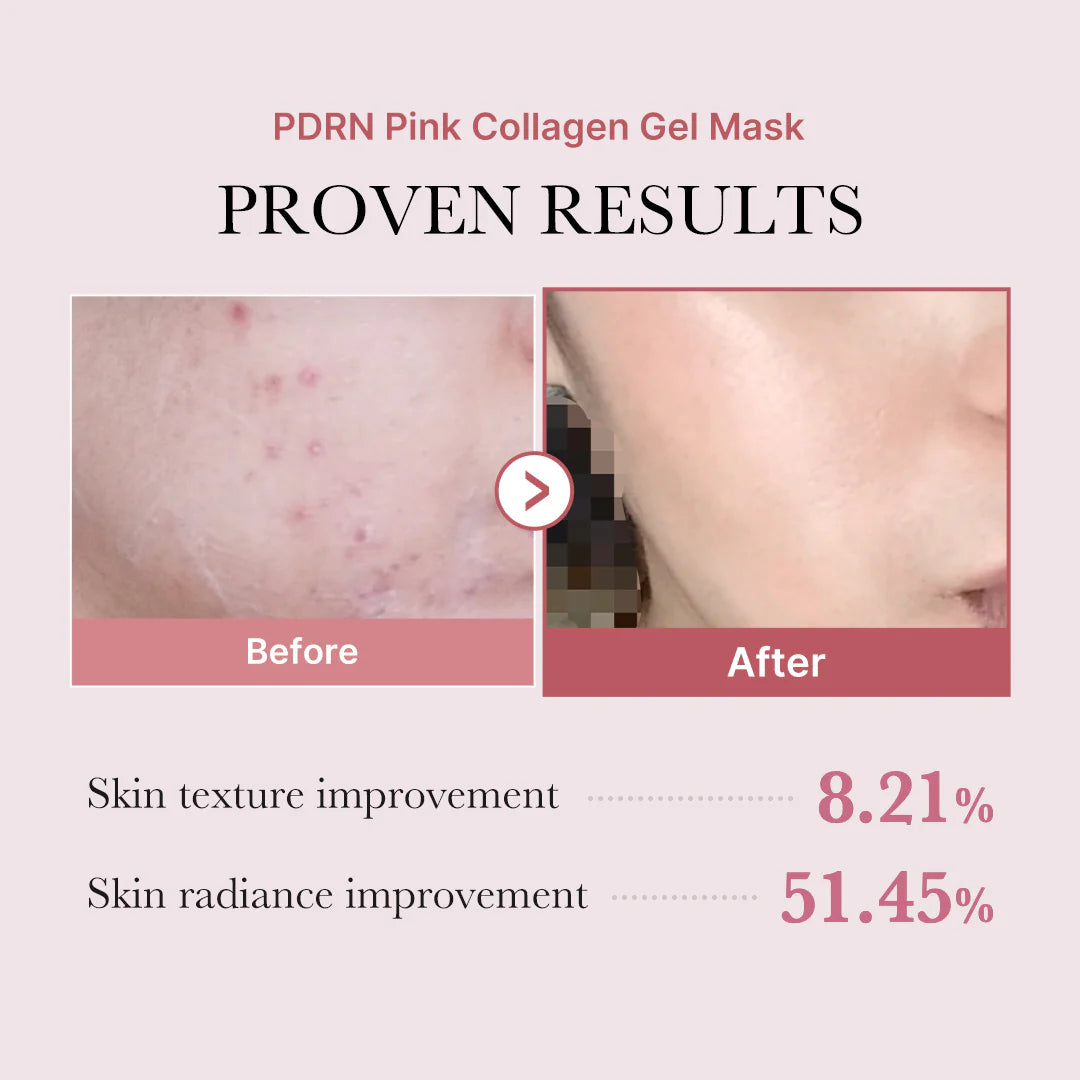 Salmon PDRN Pink Collagen Jelly Gel Mask pack 4 unidades