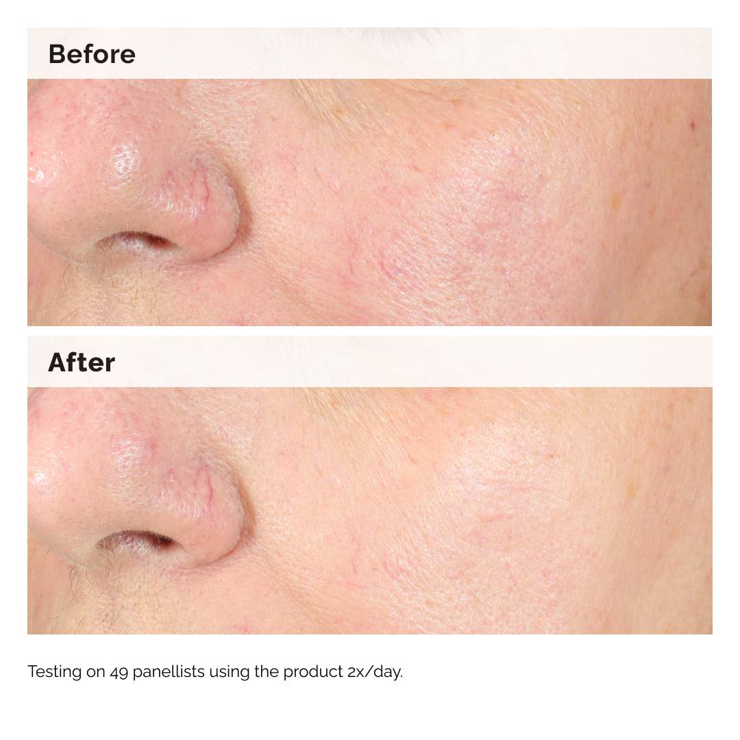 The Ordinary Alpha Arbutin 2% + HA | Sérum Antimanchas