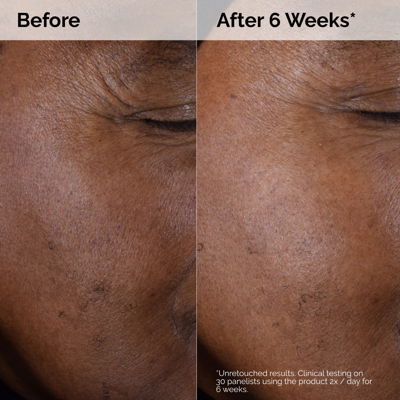 The Ordinary Glycolic Acid 7% Toning Solution | Solución Tónica