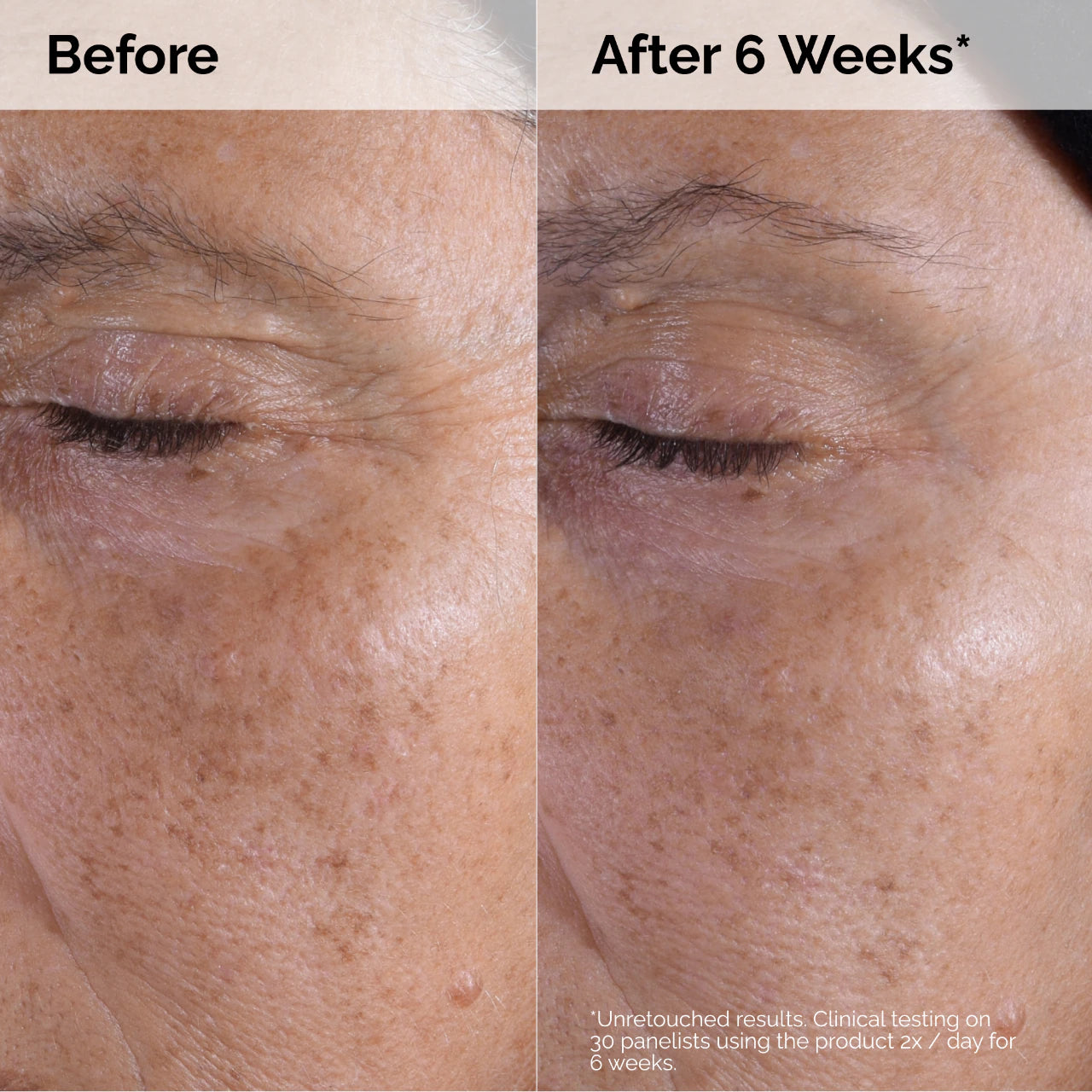 The Ordinary Glycolic Acid 7% Toning Solution | Solución Tónica