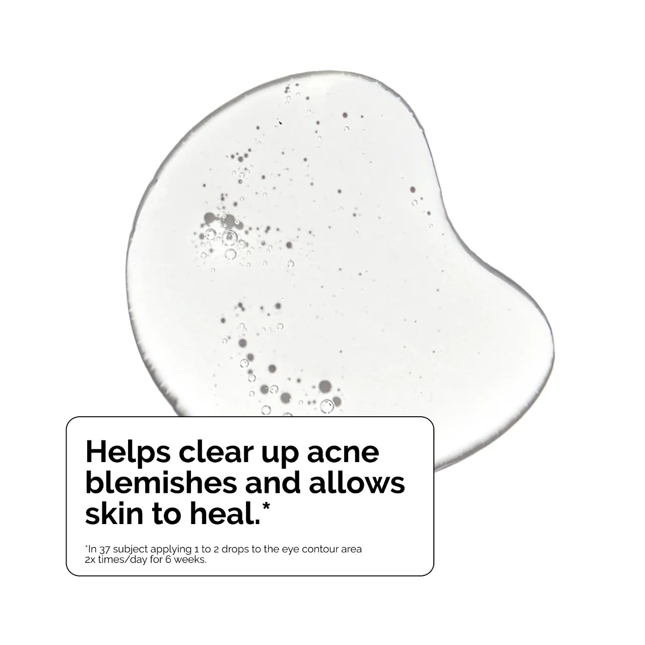 The Ordinary Salicylic Acid 2% Solution 30ml |Tratamiento Ácido Salicílico