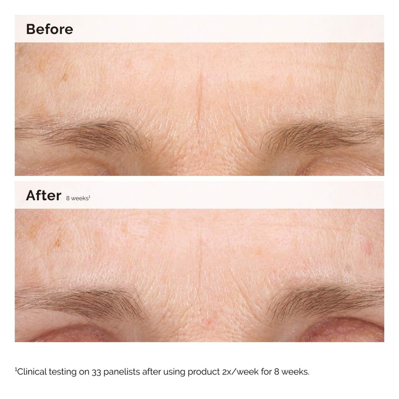 The Ordinary Emulsión de Retinal 0.2%