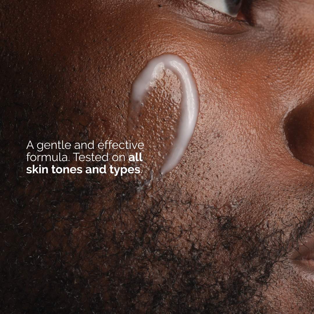 Emulsión facial y corporal con Niacinamida al 5% The Ordinary