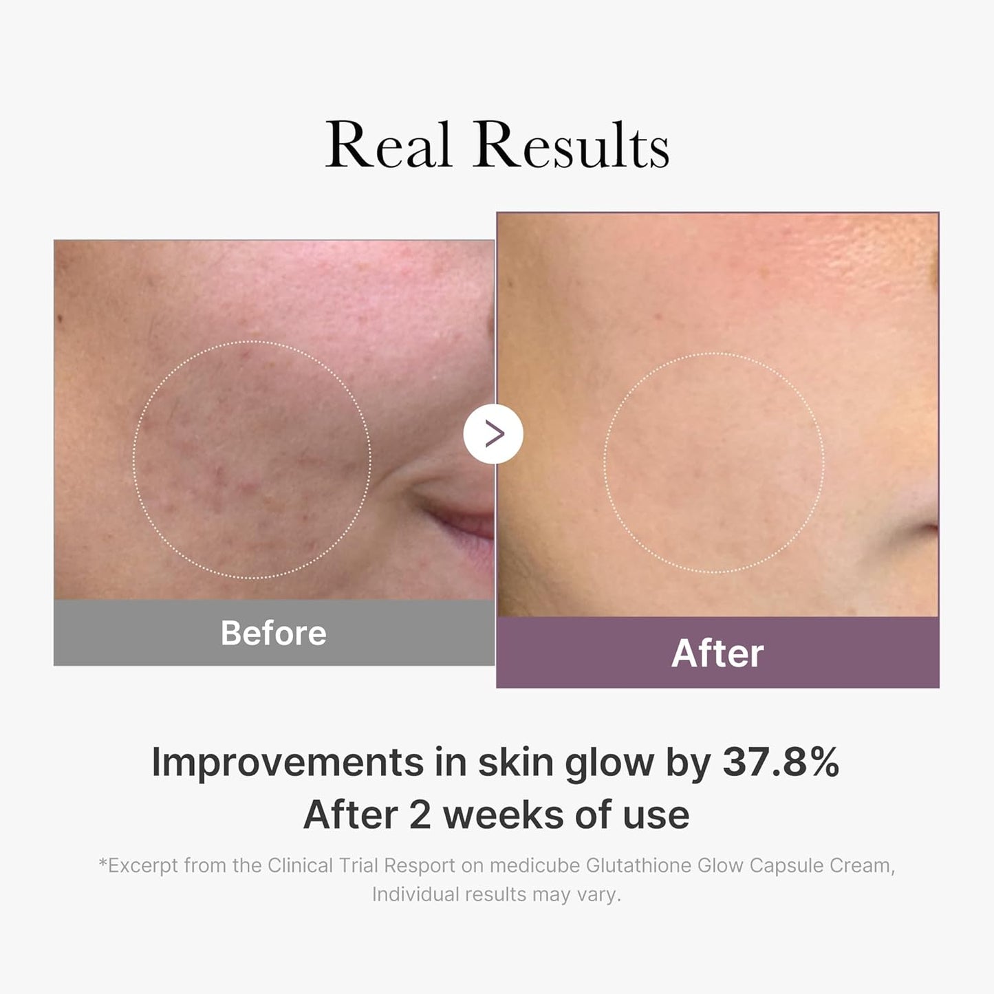 [Crema] Medicube AGE-R Glutathione Glow Capsule Cream 50ml