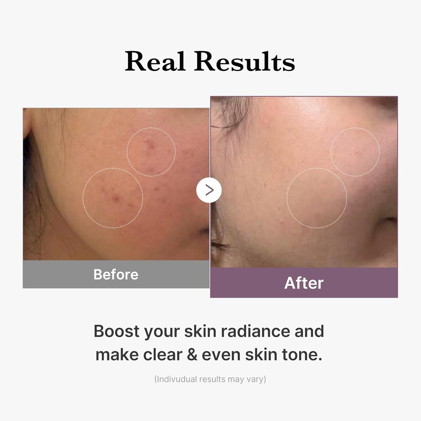 [Tónico glow] Medicube AGE-R Glutathione Glow Toner 140ml