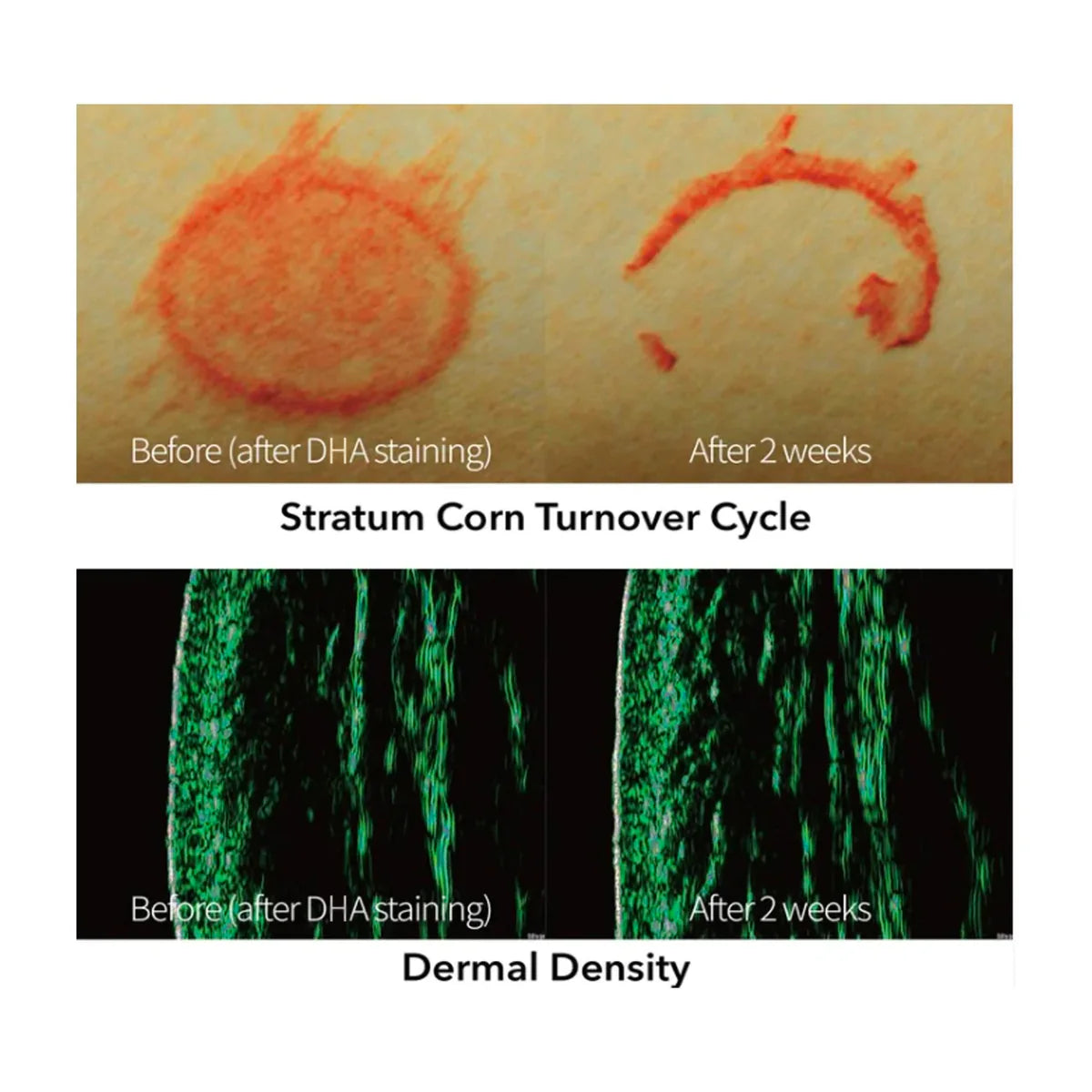 Rejuran Turnover Ampoule PDRN