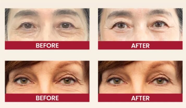 Seoul 1988 Eye Cream Retinal
