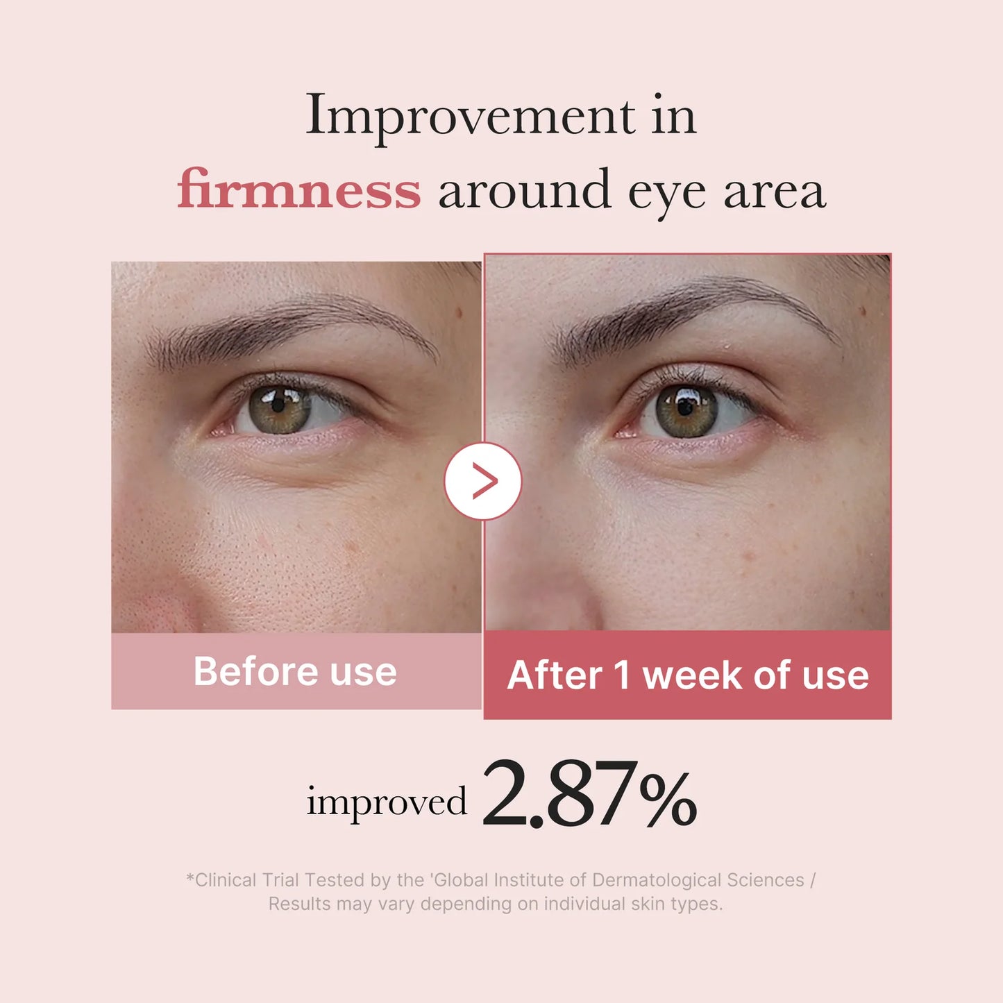 Medicube - PDRN Pink Peptide Eye Cream 30ml