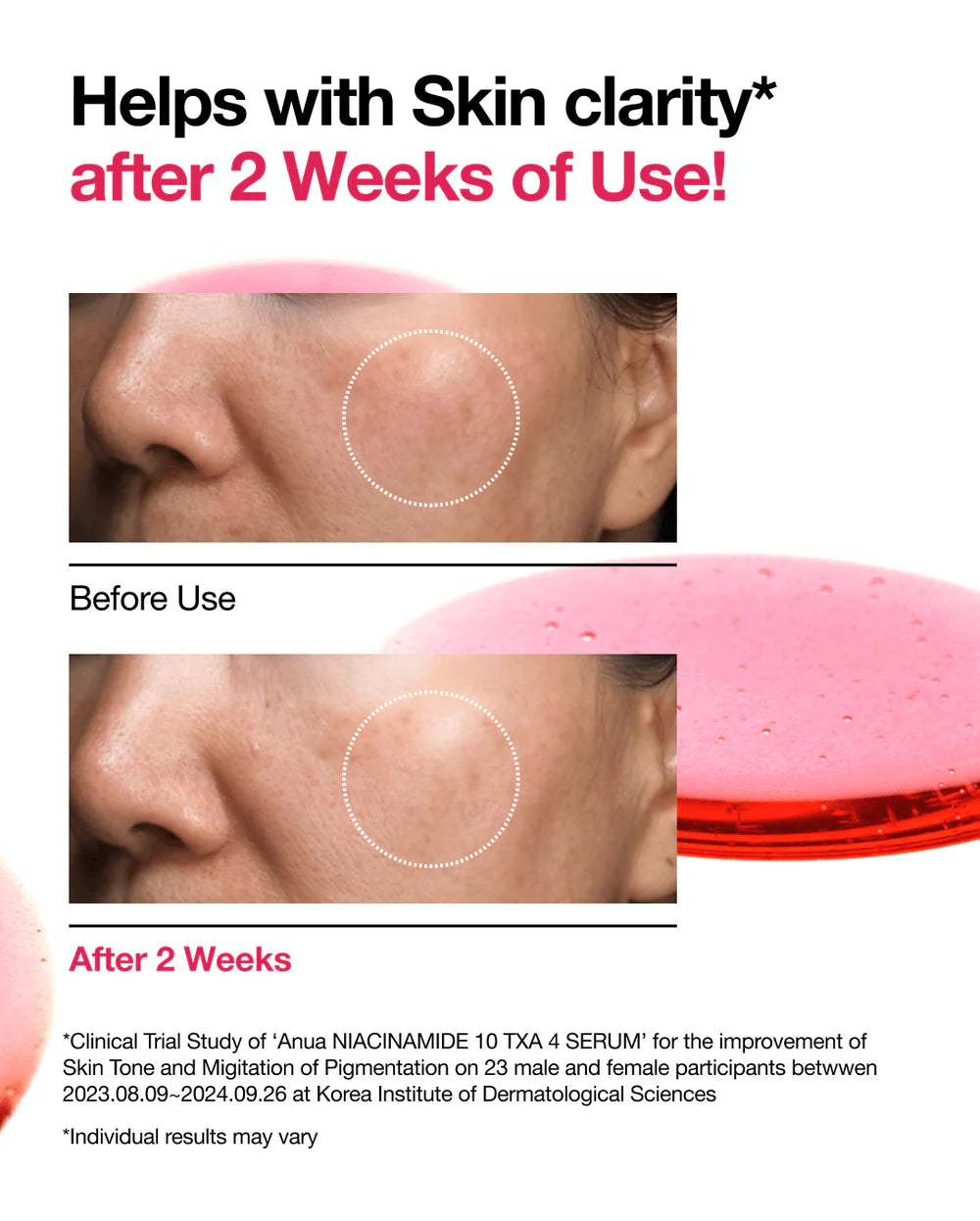 Anua - Sérum con Niacinamida Niacinamide 10% + TXA 4% Serum 30ml